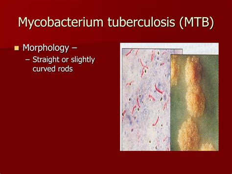 PPT - MYCOBACTERIA PowerPoint Presentation, free download - ID:3338963