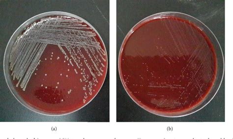 Figure 1 from The Characteristics of Staphylococcus aureus Small Colony ...