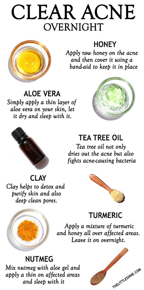 NATURAL REMEDIES TO CLEAR ACNE OVERNIGHT - The Little Shine