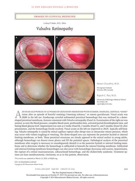 (PDF) Valsalva Retinopathy