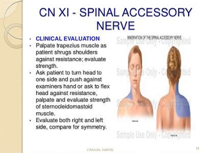 SPINAL ACCESSORY NERVE | Cranial nerves, Sternocleidomastoid muscle, Nerve