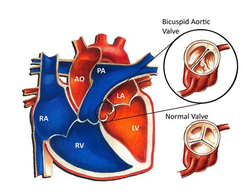 Bicuspid Valve | www.pixshark.com - Images Galleries With A Bite!