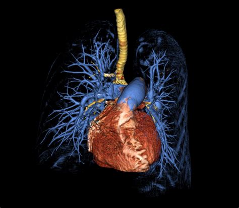 Novel blood test helps evaluate severity in pulmonary arterial ...