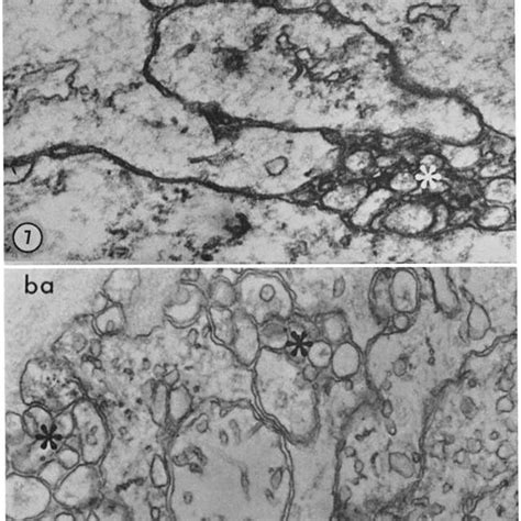 Effect of 100 g/ml of cottonmouth venom on the structure of the sheath ...