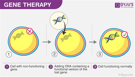 1 Gene Therapy Would Describe Which of the Following Scenarios