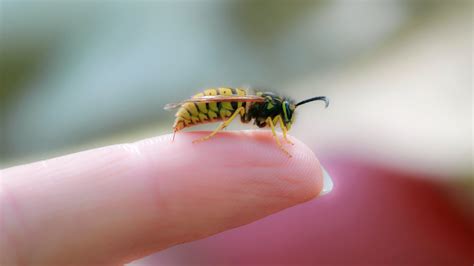 How to Treat a Bee Sting: Self-Care Instructions - GoodRx