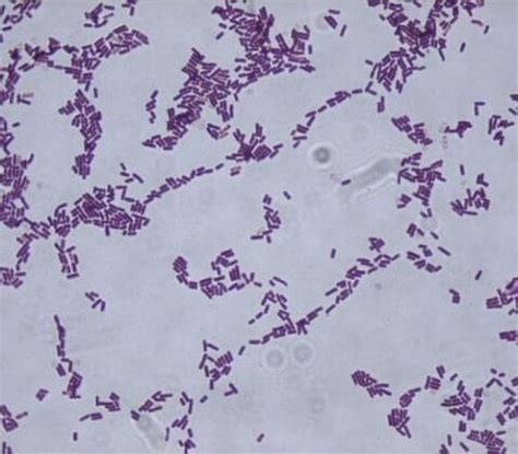 Bacillus subtilis- An Overview and Applications