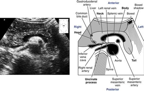 Pancreas Scanning Protocol | Radiology Key