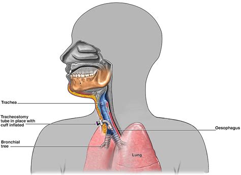 Tracheostomy Procedure Anatomy