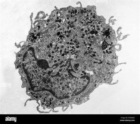 Electron micrograph of macrophage in canine lung tissue Stock Photo - Alamy