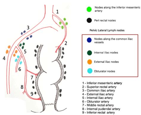 Hen period reference colon cancer lymph nodes Debtor cold Treason