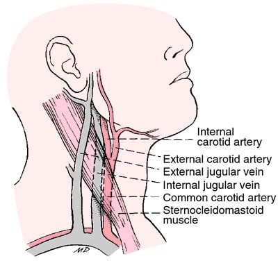 Jugular vein engorgement | definition of jugular vein engorgement by ...