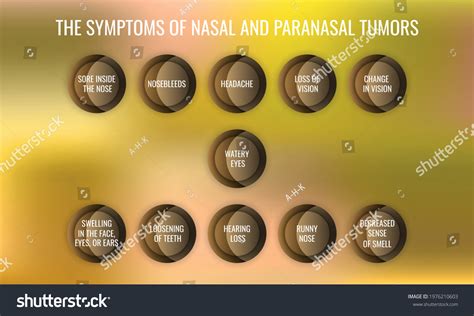 Symptoms Nasal Paranasal Tumors Vector Illustration Stock Vector ...