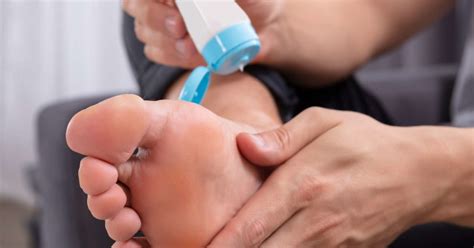 Itchy feet: 10 causes and how to get relief