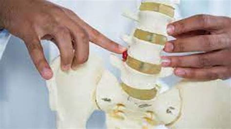 Slipped Disc Surgery in India: Causes, Procedure, Hospitals