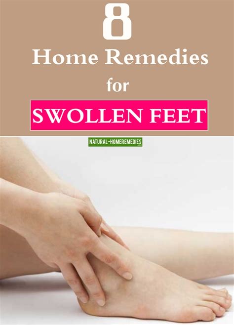 8 Natural Home Remedies For Swollen Feet – Natural Home Remedies ...