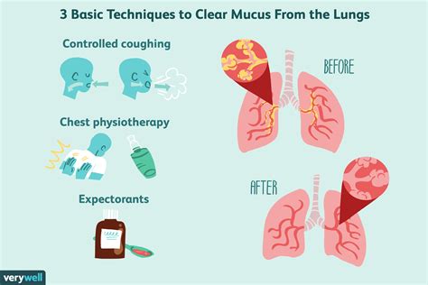 How to Treat Increased Mucus in the Lungs