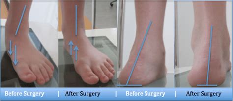 image1 - Perth Podiatric Surgery