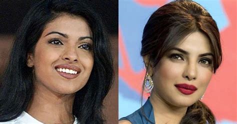 Priyanka Chopra Recalls The Botched Nose Job That Changed Her Look ...