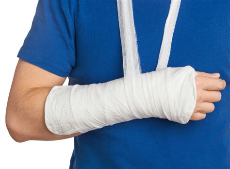 How to Treat a Colles Fracture | All-Pro Orthopedics & Sports Medicine