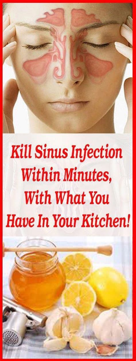 One Of The Best Home Remedy For Sinus Infection #MEDICAL-HEALTH-DIET ...