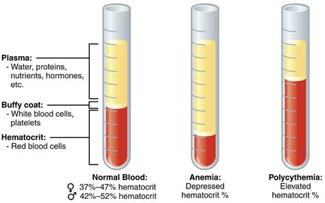 Polycythemia - Wikipedia