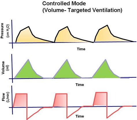 Mechanical ventilation types, indications, complications, settings & modes