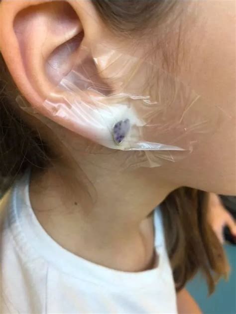 Girl, 7, hospitalised after getting ears pierced at Claire's ...