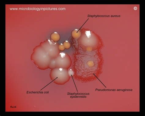 Bacteria: E.coli, P.aeruginosa, S.aureus, S.epidermidis on blood agar ...