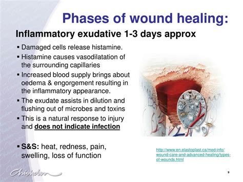 PPT - Physiology of wound healing PowerPoint Presentation, free ...