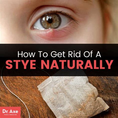 How to Get Rid of a Stye: Follow These 5 Home Remedies - Dr. Axe