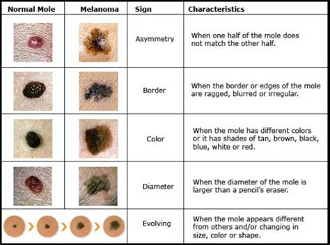 Should you be worried about Skin Cancer on your Dog? | Ammo the Dachshund