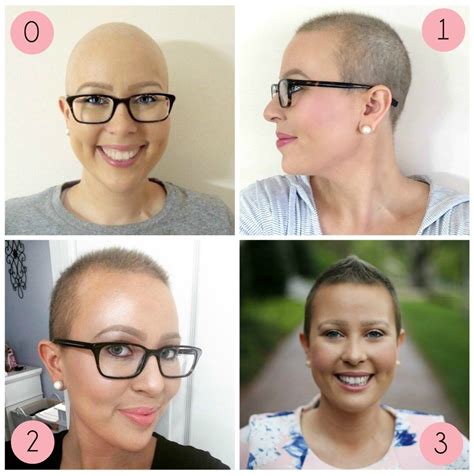 Preparing for Hair Loss During Chemo – Fashion Digger