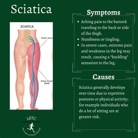 Living With Sciatica Pain - Loudoun Sports Therapy Center