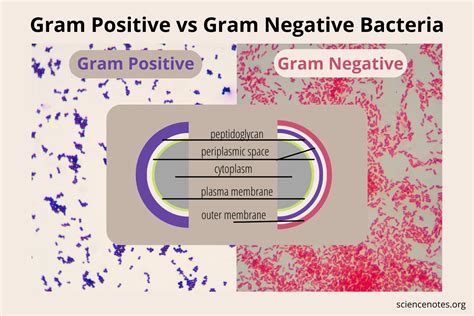 Gram Positive vs Gram Negative Bacteria