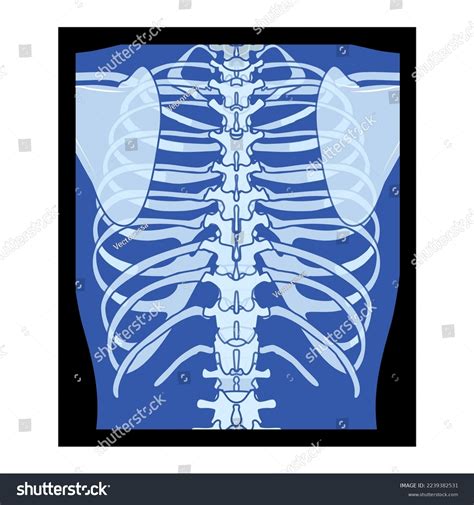 X-ray Rib Cage Skeleton Human Body Stock Vector (Royalty Free ...