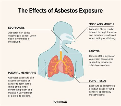 Asbestos Exposure | The Brinton Firm