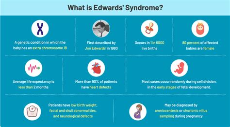 Causes and Treatment For Edwards’ Syndrome (Trisomy 18) in Children