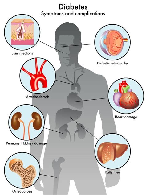 Diabetes and Vascular Disease