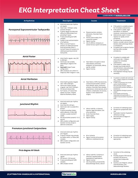 Printable Ekg Cheat Sheet