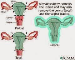 Medical Treatment Pictures-for Better Understanding: Abdominal ...