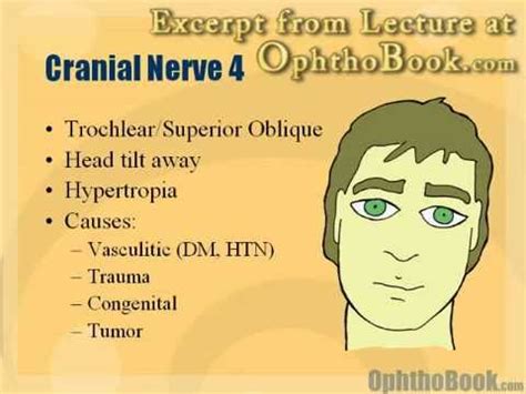 Cranial Nerve 6 palsy | Doovi