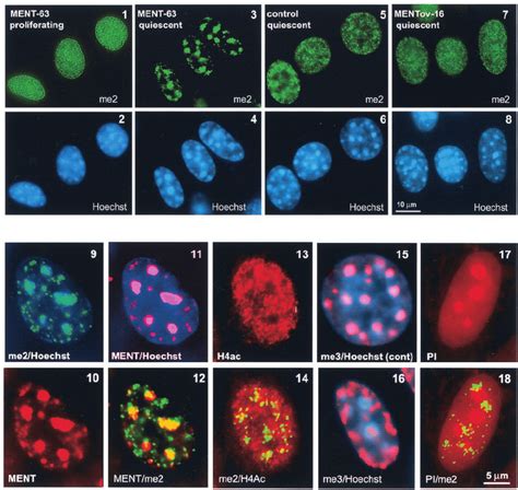 Rearrangement of chromatin marked by histone H3 methylation in ...