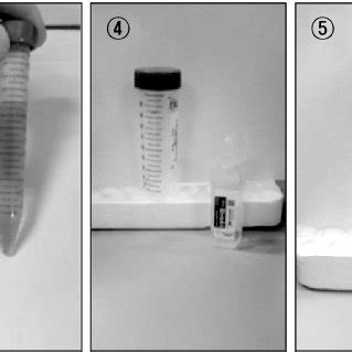 (PDF) Preparation of Autologous Serum Eye Drops