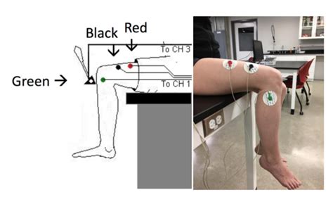 Assessment of Patellar and Achilles Reflexes – A Mixed Course-Based ...