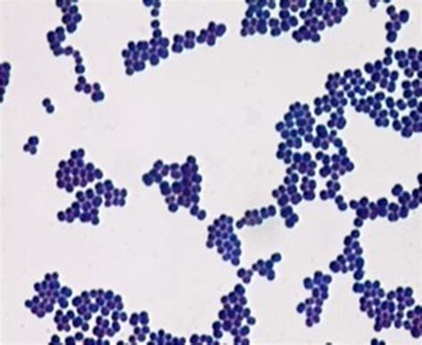 Gram positive vs gram negative cluster - minenh