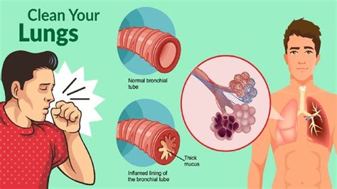 Get Rid of Phlegm and Mucus in Chest & Throat Instantly - Health Cares