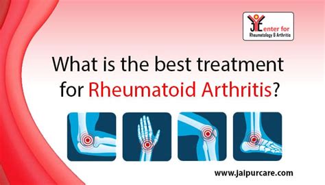 What is the best treatment for rheumatoid arthritis?