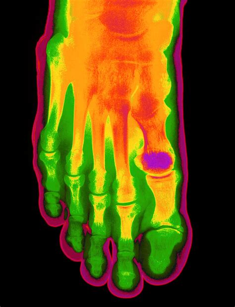 Coloured X-ray Of A Healthy Foot (top View) Photograph by Mehau Kulyk ...