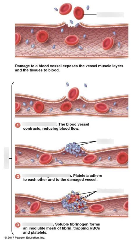 Stages of Hemostasis Diagram Diagram | Quizlet